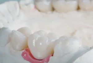 dentisterie_esthetique