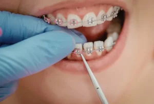 dentisterie_esthetique