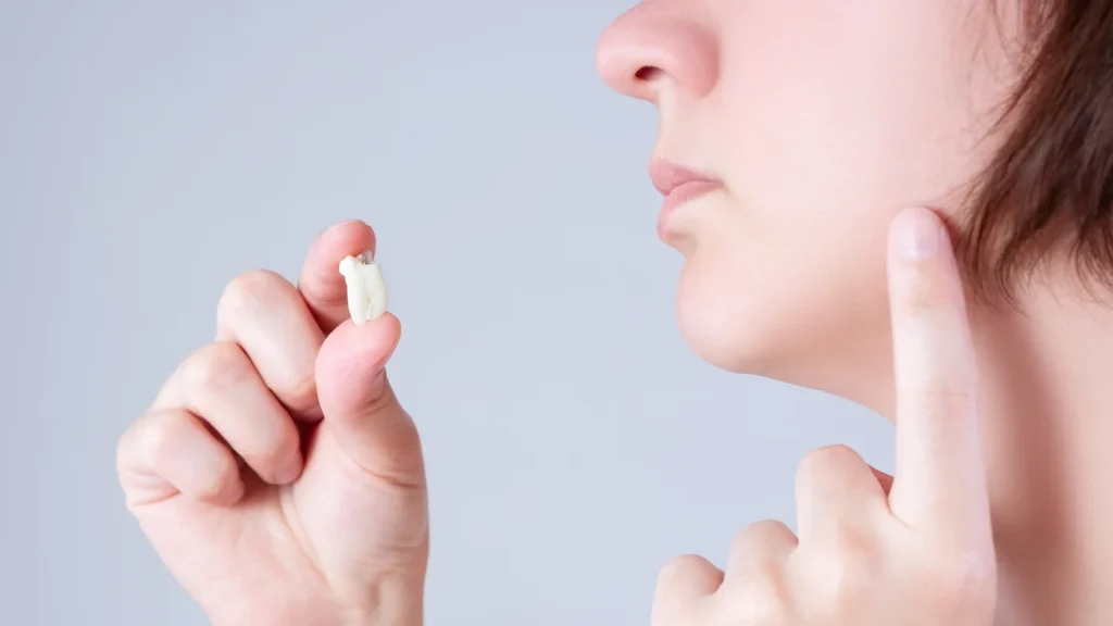 wisdom tooth extraction